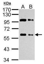 c-Myc Antibody in Western Blot (WB)