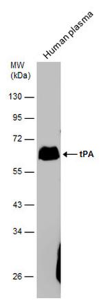tPA Antibody in Western Blot (WB)