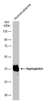 Haptoglobin Antibody in Western Blot (WB)