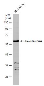 Calcineurin A Antibody in Western Blot (WB)