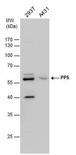 PP5 Antibody in Western Blot (WB)