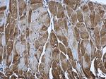 PUS1 Antibody in Immunohistochemistry (Paraffin) (IHC (P))