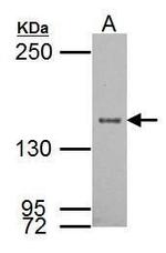 SRC1 Antibody in Western Blot (WB)