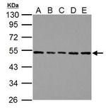 beta Tubulin Antibody in Western Blot (WB)