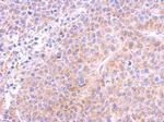 beta Tubulin Antibody in Immunohistochemistry (Paraffin) (IHC (P))