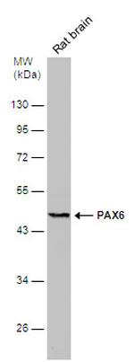 PAX6 Antibody in Western Blot (WB)