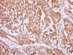 NQO1 Antibody in Immunohistochemistry (Paraffin) (IHC (P))