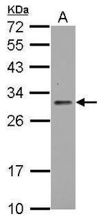 TIGAR Antibody in Western Blot (WB)