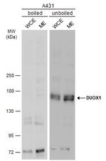 DUOX1 Antibody in Western Blot (WB)