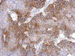 EGFR Antibody in Immunohistochemistry (Paraffin) (IHC (P))