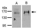 EGFR Antibody in Immunoprecipitation (IP)