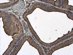 beta Actin Antibody in Immunohistochemistry (Paraffin) (IHC (P))