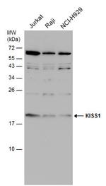 KISS1 Antibody in Western Blot (WB)