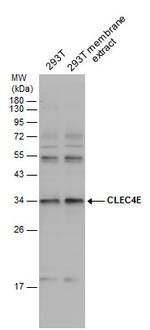 CLEC4E Antibody in Western Blot (WB)