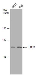 USP20 Antibody in Western Blot (WB)