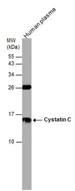 Cystatin C Antibody in Western Blot (WB)