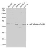 Phospho-AKT1 (Thr450) Antibody in Western Blot (WB)