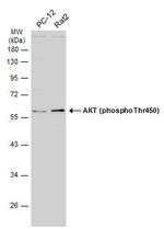 Phospho-AKT1 (Thr450) Antibody in Western Blot (WB)