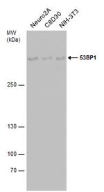 53BP1 Antibody in Western Blot (WB)