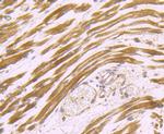 Dysferlin Antibody in Immunohistochemistry (Paraffin) (IHC (P))