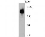 Dysferlin Antibody in Western Blot (WB)