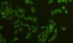 alpha Tubulin Antibody in Immunocytochemistry (ICC/IF)