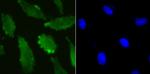 UBA3 Antibody in Immunocytochemistry (ICC/IF)