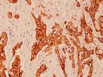 Cytokeratin 8 Antibody in Immunohistochemistry (Paraffin) (IHC (P))