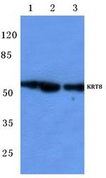 Cytokeratin 8 Antibody in Western Blot (WB)