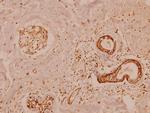 MMP11 Antibody in Immunohistochemistry (Paraffin) (IHC (P))