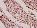 Ku80 Antibody in Immunohistochemistry (Paraffin) (IHC (P))