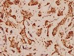 Bcl-X Antibody in Immunohistochemistry (Paraffin) (IHC (P))