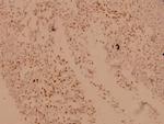 CRYAB Antibody in Immunohistochemistry (Paraffin) (IHC (P))