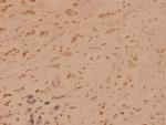 SSB Antibody in Immunohistochemistry (Paraffin) (IHC (P))