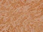 RhoA Antibody in Immunohistochemistry (Paraffin) (IHC (P))