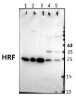 TPT1 Antibody in Western Blot (WB)