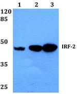 IRF2 Antibody in Western Blot (WB)