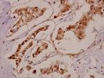 BRD3 Antibody in Immunohistochemistry (Paraffin) (IHC (P))