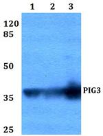 PIG3 Antibody in Western Blot (WB)
