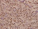 CDK2 Antibody in Immunohistochemistry (Paraffin) (IHC (P))