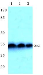 CDK2 Antibody in Western Blot (WB)