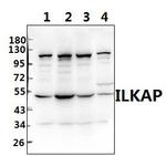 ILKAP Antibody in Western Blot (WB)