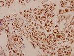 p73 Antibody in Immunohistochemistry (Paraffin) (IHC (P))