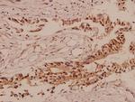 TCF3 Antibody in Immunohistochemistry (Paraffin) (IHC (P))