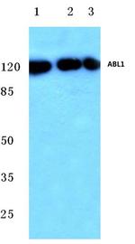 c-Abl Antibody in Western Blot (WB)