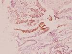 PIK3R2 Antibody in Immunohistochemistry (Paraffin) (IHC (P))