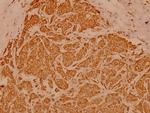 Cytokeratin 19 Antibody in Immunohistochemistry (Paraffin) (IHC (P))