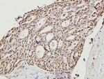 Cofilin Antibody in Immunohistochemistry (Paraffin) (IHC (P))