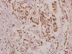 VASP Antibody in Immunohistochemistry (Paraffin) (IHC (P))