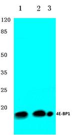 4EBP1 Antibody in Western Blot (WB)